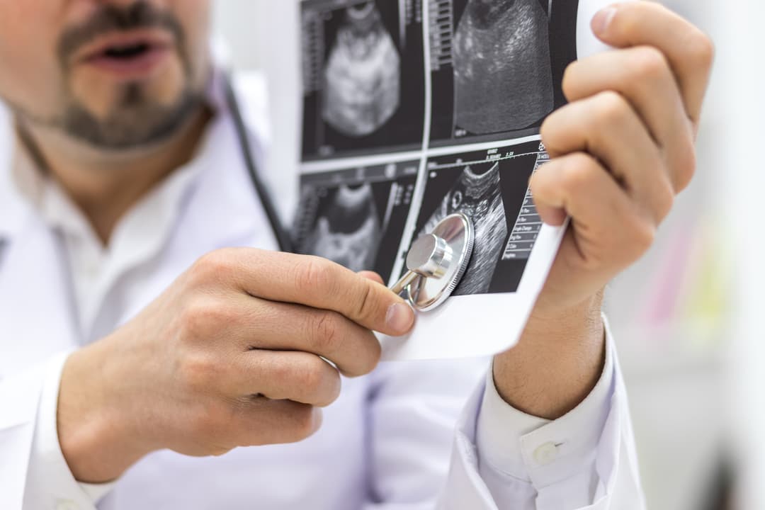 Diagnosticos de ultrasonido obstetrico en Puebla